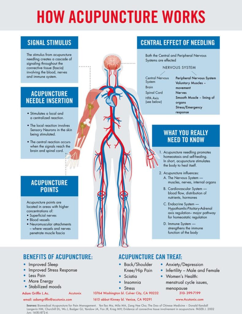 Acupuncture